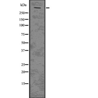 PLEC / Plectin Antibody - Western blot analysis of PLEC using Jurkat whole lysates.