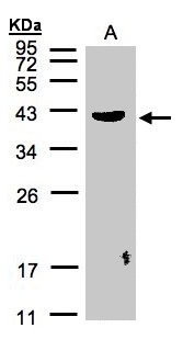 PLEK / Pleckstrin Antibody - Sample (30 ug of whole cell lysate). A: Raji. 12% SDS PAGE. PLEK / Pleckstrin antibody diluted at 1:500