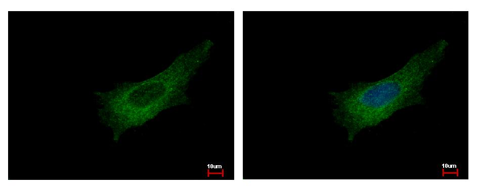 PLEK / Pleckstrin Antibody - Pleckstrin antibody [C2C3], C-term detects PLEK protein at cytoplasm by immunofluorescent analysis. HeLa cells were fixed in -20 100% MeOH for 5 min. PLEK protein stained by Pleckstrin antibody [C2C3], C-term diluted at 1:500. 
