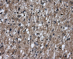 PLEK / Pleckstrin Antibody - IHC of paraffin-embedded liver tissue using anti-PLEK mouse monoclonal antibody. (Dilution 1:50).