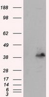PLEK / Pleckstrin Antibody - HEK293T cells were transfected with the pCMV6-ENTRY control (Left lane) or pCMV6-ENTRY PLEK (Right lane) cDNA for 48 hrs and lysed. Equivalent amounts of cell lysates (5 ug per lane) were separated by SDS-PAGE and immunoblotted with anti-PLEK.