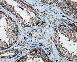 PLEK / Pleckstrin Antibody - IHC of paraffin-embedded prostate tissue using anti-PLEK mouse monoclonal antibody. (Dilution 1:50).