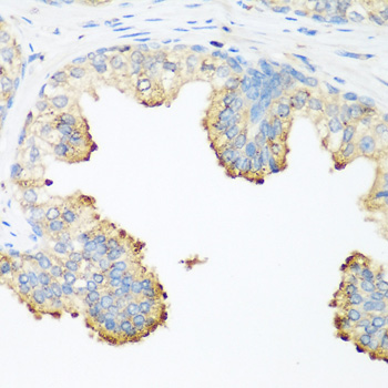 PLEK / Pleckstrin Antibody - Immunohistochemistry of paraffin-embedded human prostate.