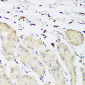 PLEK / Pleckstrin Antibody - Immunohistochemistry of paraffin-embedded human gastric tissue.