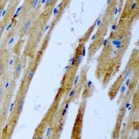 PLEK / Pleckstrin Antibody - Immunohistochemical analysis of Pleckstrin staining in rat heart formalin fixed paraffin embedded tissue section. The section was pre-treated using heat mediated antigen retrieval with sodium citrate buffer (pH 6.0). The section was then incubated with the antibody at room temperature and detected using an HRP conjugated compact polymer system. DAB was used as the chromogen. The section was then counterstained with hematoxylin and mounted with DPX.