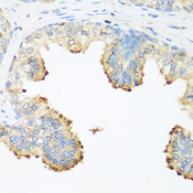 PLEK / Pleckstrin Antibody - Immunohistochemistry of paraffin-embedded human prostate using PLEK antibody at dilution of 1:200 (40x lens).