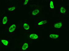 PLEK / Pleckstrin Antibody - Immunofluorescence staining of PLEK in Hela cells. Cells were fixed with 4% PFA, permeabilzed with 0.3% Triton X-100 in PBS, blocked with 10% serum, and incubated with rabbit anti-Human PLEK polyclonal antibody (dilution ratio 1:1000) at 4°C overnight. Then cells were stained with the Alexa Fluor 488-conjugated Goat Anti-rabbit IgG secondary antibody (green). Positive staining was localized to nucleus.