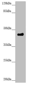 PLEKHA1 Antibody - Western blot All Lanes:PLEKHA1 antibody at 3.11 ug/ml +A549 whole cell lysate Secondary Goat polyclonal to rabbit IgG at 1/10000 dilution Predicted band size: 46,39 kDa Observed band size: 46 kDa