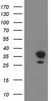 PLEKHA3 Antibody - HEK293T cells were transfected with the pCMV6-ENTRY control (Left lane) or pCMV6-ENTRY PLEKHA3 (Right lane) cDNA for 48 hrs and lysed. Equivalent amounts of cell lysates (5 ug per lane) were separated by SDS-PAGE and immunoblotted with anti-PLEKHA3.