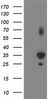 PLEKHA3 Antibody - HEK293T cells were transfected with the pCMV6-ENTRY control (Left lane) or pCMV6-ENTRY PLEKHA3 (Right lane) cDNA for 48 hrs and lysed. Equivalent amounts of cell lysates (5 ug per lane) were separated by SDS-PAGE and immunoblotted with anti-PLEKHA3.