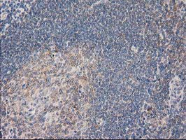 PLEKHA3 Antibody - IHC of paraffin-embedded Human lymph node tissue using anti-PLEKHA3 mouse monoclonal antibody.
