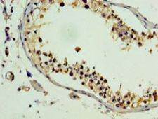 PLEKHB2 Antibody - Immunohistochemistry of paraffin-embedded human testis using antibody at 1:100 dilution.  This image was taken for the unconjugated form of this product. Other forms have not been tested.