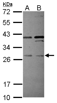 PLEKHF2 Antibody - Sample (30 ug of whole cell lysate) A: Jurkat B: Raji 12% SDS PAGE PLEKHF2 antibody diluted at 1:500
