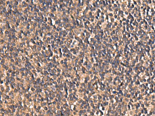 PLEKHF2 Antibody - Immunohistochemistry of paraffin-embedded Human tonsil tissue  using PLEKHF2 Polyclonal Antibody at dilution of 1:85(×200)