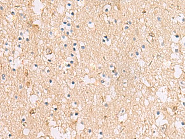 PLEKHF2 Antibody - Immunohistochemistry of paraffin-embedded Human brain tissue  using PLEKHF2 Polyclonal Antibody at dilution of 1:85(×200)