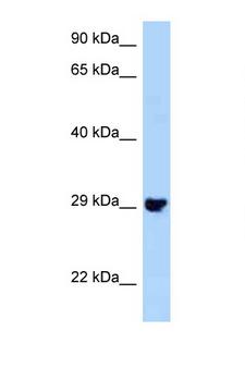 PLEKHF2 Antibody - PLEKHF2 antibody Western blot of Mouse Kidney lysate. Antibody concentration 1 ug/ml.  This image was taken for the unconjugated form of this product. Other forms have not been tested.