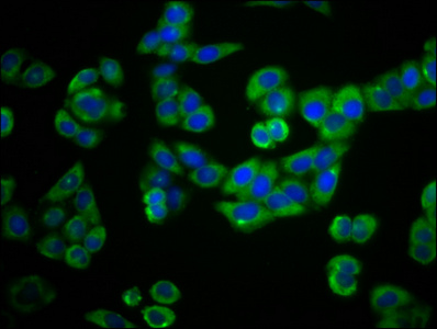 PLEKHG5 Antibody - Immunofluorescence staining of PC3 cells diluted at 1:66, counter-stained with DAPI. The cells were fixed in 4% formaldehyde, permeabilized using 0.2% Triton X-100 and blocked in 10% normal Goat Serum. The cells were then incubated with the antibody overnight at 4°C.The Secondary antibody was Alexa Fluor 488-congugated AffiniPure Goat Anti-Rabbit IgG (H+L).