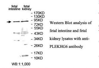 PLEKHG6 Antibody