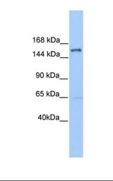 PLEKHH2 Antibody - Jurkat cell lysate. Antibody concentration: 1.0 ug/ml. Gel concentration: 6-18%.  This image was taken for the unconjugated form of this product. Other forms have not been tested.