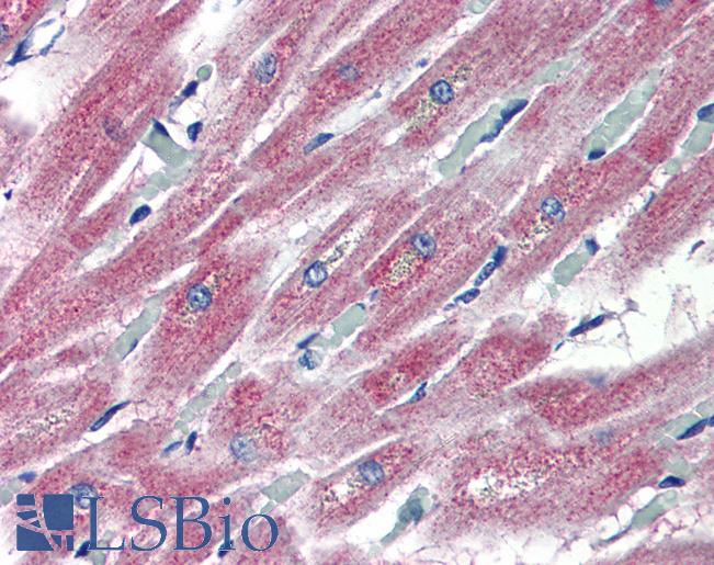 PLEKHH2 Antibody - Anti-PLEKHH2 antibody IHC of human heart. Immunohistochemistry of formalin-fixed, paraffin-embedded tissue after heat-induced antigen retrieval. Antibody concentration 10 ug/ml.  This image was taken for the unconjugated form of this product. Other forms have not been tested.