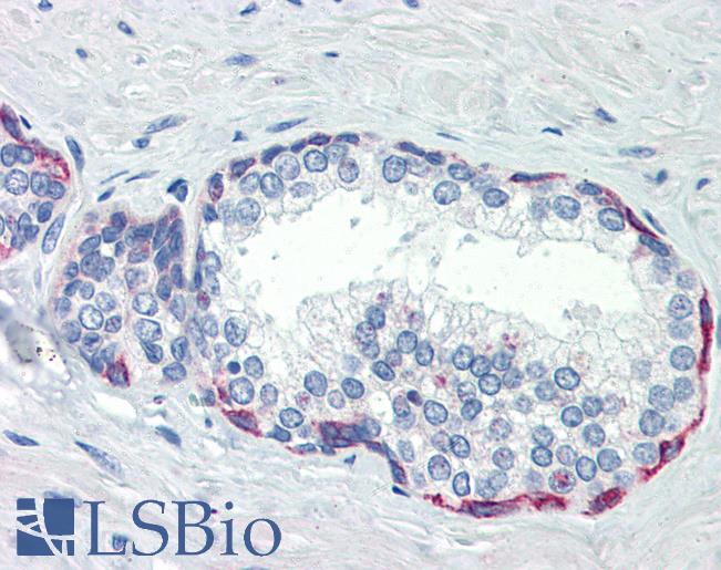 PLEKHH2 Antibody - Anti-PLEKHH2 antibody IHC of human prostate. Immunohistochemistry of formalin-fixed, paraffin-embedded tissue after heat-induced antigen retrieval. Antibody concentration 10 ug/ml.  This image was taken for the unconjugated form of this product. Other forms have not been tested.