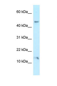 PLEKHJ1 Antibody - PLEKHJ1 antibody Western blot of 721_B Cell lysate. Antibody concentration 1 ug/ml.  This image was taken for the unconjugated form of this product. Other forms have not been tested.