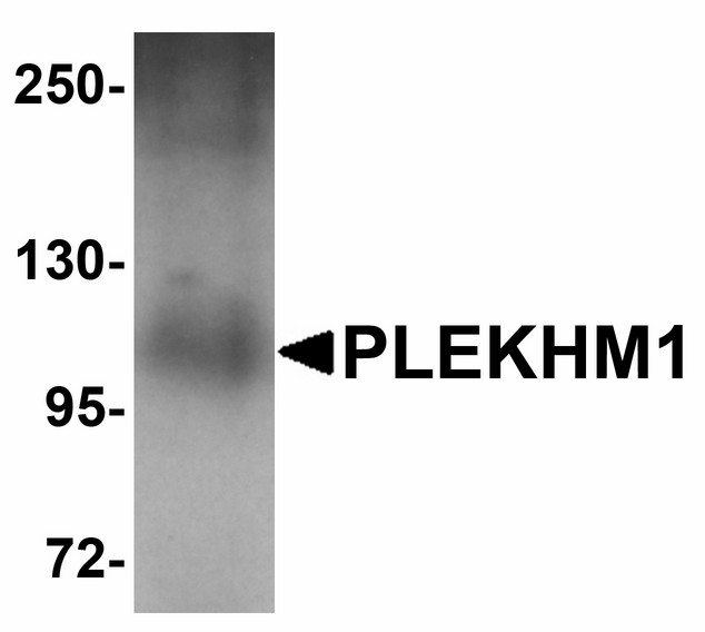 PLEKHM1 Antibody - Western blot of PLEKHM1 in human lung tissue lysate with PLEKHM1 antibody at 1 ug/ml. Below: Immunohistochemistry of PLEKHM1 in human lung tissue with PLEKHM1 antibody at 5 ug/ml.