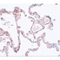 PLEKHM1 Antibody - Immunohistochemistry of PLEKHM1 in human lung tissue with PLEKHM1 antibody at 5 µg/mL.