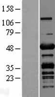 PLEKHO1 / CKIP-1 Protein - Western validation with an anti-DDK antibody * L: Control HEK293 lysate R: Over-expression lysate