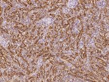 PLEKHO2 Antibody - Immunochemical staining of human PLEKHO2 in human spleen with rabbit polyclonal antibody at 1:100 dilution, formalin-fixed paraffin embedded sections.