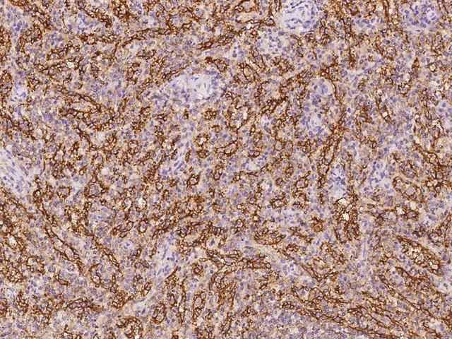 PLEKHO2 Antibody - Immunochemical staining of human PLEKHO2 in human spleen with rabbit polyclonal antibody at 1:100 dilution, formalin-fixed paraffin embedded sections.
