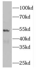 PLEKHO2 Antibody - HeLa cells were subjected to SDS PAGE followed by western blot with PLEKHO2 antibody at dilution of 1:300