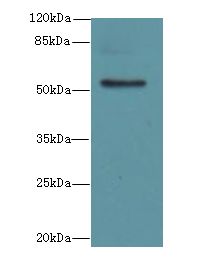 PLEKHS1 / C10orf81 Antibody - Western blot. All lanes: PLEKHS1 antibody at 1.5 ug/ml+ MDA-MB-231 whole cell lysate Goat polyclonal to rabbit at 1:10000 dilution. Predicted band size: 52 kDa. Observed band size: 52 kDa.