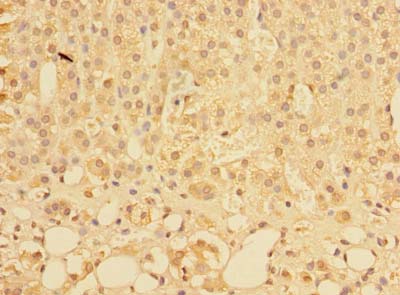 PLEKHS1 / C10orf81 Antibody - Immunohistochemistry of paraffin-embedded human adrenal gland tissue using antibody at dilution of 1:100.