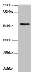 PLEKHS1 / C10orf81 Antibody - Western blot All lanes: PLEKHS1 antibody at 1.5µg/ml + MDA-MB-231 whole cell lysate Secondary Goat polyclonal to rabbit IgG at 1/10000 dilution Predicted band size: 52, 51, 41, 53 kDa Observed band size: 52 kDa