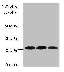 PLET1 / C11orf34 Antibody - Western blot All lanes: Plet1 antibody at 5µg/ml Lane 1: L929 whole cell lysate Lane 2: U251 whole cell lysate Lane 3: Mouse muscle tissue Secondary Goat polyclonal to rabbit IgG at 1/10000 dilution Predicted band size: 26, 21 kDa Observed band size: 26 kDa