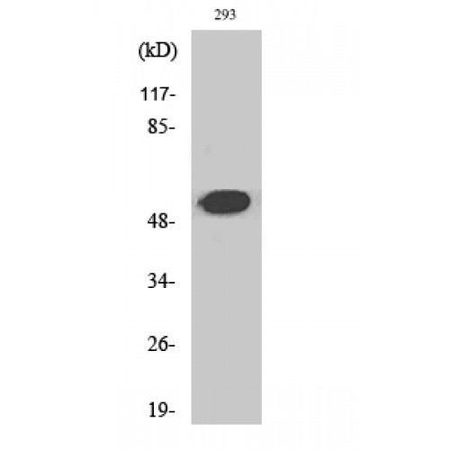 PLG / Plasmin / Plasminogen Antibody - Western blot of Cleaved-Plasminogen HC A short form (V98) antibody