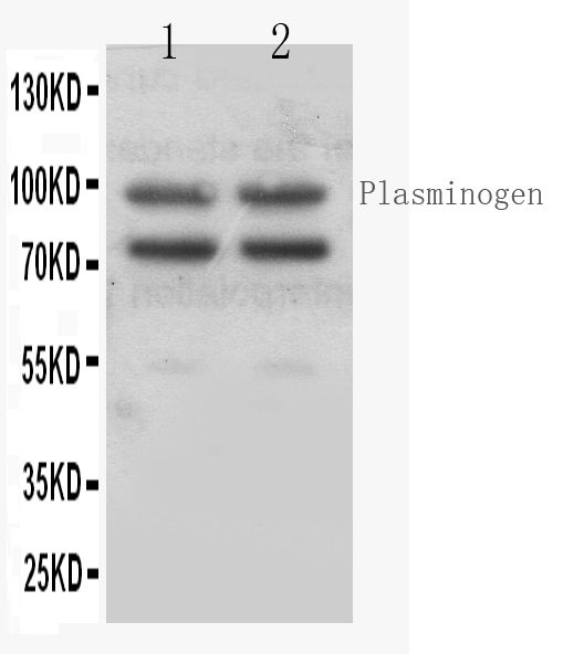 PLG / Plasmin / Plasminogen Antibody - Western blot - Anti-Angiostatin K1-3 Antibody