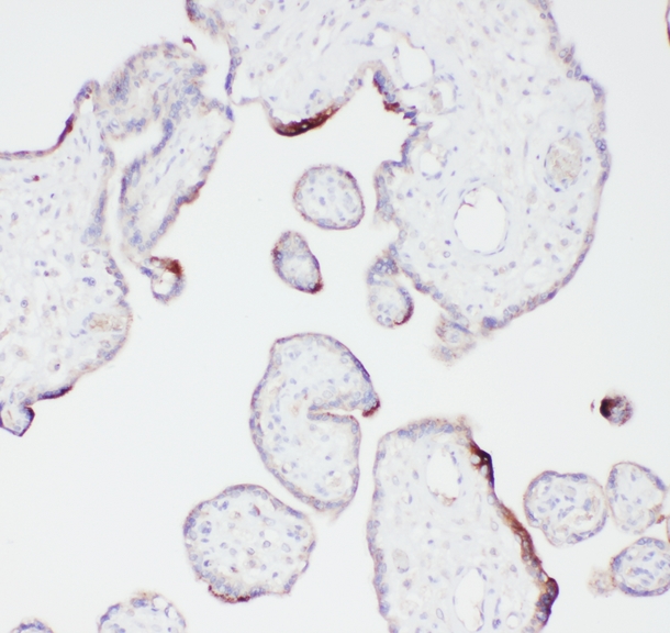 PLG / Plasmin / Plasminogen Antibody - IHC analysis of Angiostatin K1-3 using anti-Angiostatin K1-3 antibody. Angiostatin K1-3 was detected in paraffin-embedded section of human placenta tissues. Heat mediated antigen retrieval was performed in citrate buffer (pH6, epitope retrieval solution) for 20 mins. The tissue section was blocked with 10% goat serum. The tissue section was then incubated with 1µg/ml rabbit anti-Angiostatin K1-3 Antibody overnight at 4°C. Biotinylated goat anti-rabbit IgG was used as secondary antibody and incubated for 30 minutes at 37°C. The tissue section was developed using Strepavidin-Biotin-Complex (SABC) with DAB as the chromogen.