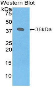 PLG / Plasmin / Plasminogen Antibody - Western blot of recombinant PLG / Plasmin / Plasminogen.  This image was taken for the unconjugated form of this product. Other forms have not been tested.