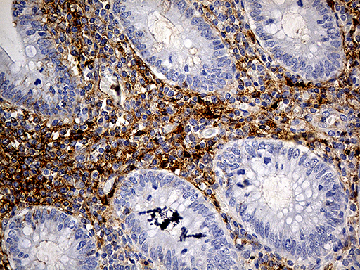 PLG / Plasmin / Plasminogen Antibody - Immunohistochemical staining of paraffin-embedded Human appendix tissue within the normal limits using anti-PLG mouse monoclonal antibody. (Heat-induced epitope retrieval by 1mM EDTA in 10mM Tris buffer. (pH8.5) at 120°C for 3 min. (1:500)