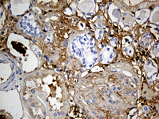 PLG / Plasmin / Plasminogen Antibody - Immunohistochemical staining of paraffin-embedded Human Kidney tissue within the normal limits using anti-PLG mouse monoclonal antibody. (Heat-induced epitope retrieval by 1mM EDTA in 10mM Tris buffer. (pH8.5) at 120°C for 3 min. (1:500)