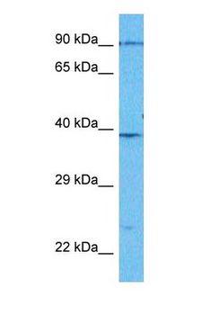 PLG / Plasmin / Plasminogen Antibody - Western blot of PLMN Antibody with human Jurkat Whole Cell lysate.  This image was taken for the unconjugated form of this product. Other forms have not been tested.