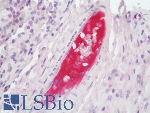 PLG / Plasmin / Plasminogen Antibody - Human Tonsil: Formalin-Fixed, Paraffin-Embedded (FFPE) 