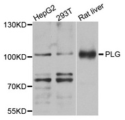 PLG / Plasmin / Plasminogen Antibody - Western blot analysis of extracts of various cells.
