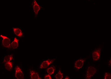 PLG / Plasmin / Plasminogen Antibody - Staining HeLa cells by IF/ICC. The samples were fixed with PFA and permeabilized in 0.1% Triton X-100, then blocked in 10% serum for 45 min at 25°C. The primary antibody was diluted at 1:200 and incubated with the sample for 1 hour at 37°C. An Alexa Fluor 594 conjugated goat anti-rabbit IgG (H+L) Ab, diluted at 1/600, was used as the secondary antibody.