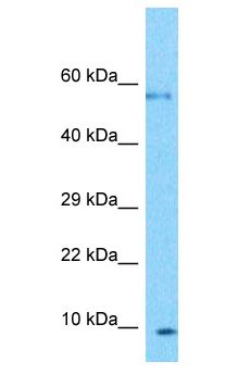 PLGLB2 / PLGLB1 Antibody - PLGLB2 / PLGLB1 antibody Western Blot of U937. Antibody dilution: 1 ug/ml.  This image was taken for the unconjugated form of this product. Other forms have not been tested.