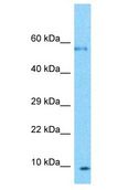 PLGLB2 / PLGLB1 Antibody - PLGLB2 / PLGLB1 antibody Western Blot of U937. Antibody dilution: 1 ug/ml.  This image was taken for the unconjugated form of this product. Other forms have not been tested.