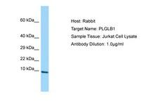 PLGLB2 / PLGLB1 Antibody -  This image was taken for the unconjugated form of this product. Other forms have not been tested.