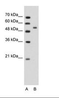 PLIN1 / Perilipin Antibody - A: Marker, B: Jurkat Cell Lysate.  This image was taken for the unconjugated form of this product. Other forms have not been tested.